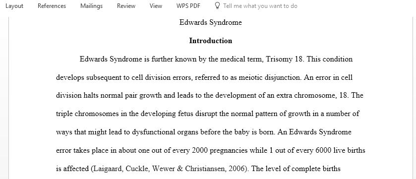 Assess the etiological, prognostic and diagnostic Edward syndrome characteristics