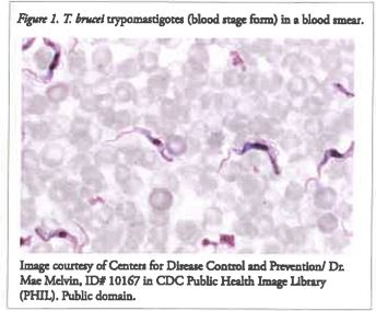 Figure 1. T. brucel trypomastigotes blood stage form in a blood smear.